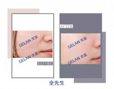 t(y)ĤNӹN Vݸ{(ln)